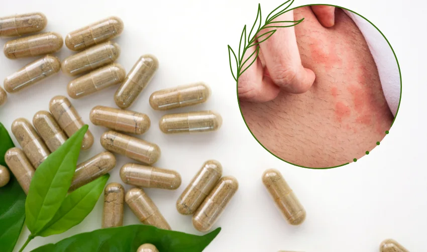 Top 10 Natural Anti-Inflammatory Supplements