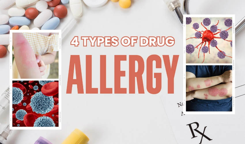 Allergy types for drugs